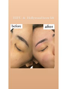 エールバイボヌール(Ere by Bonheur)/Hollywoodbrowlift+フェイシャル