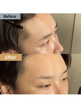 眉毛ハウス 吉祥寺店(眉毛HOUSE)/お客様の施術例(吉祥寺/東京)