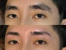 メンズ脱毛サロン ボス(BOSS)/失敗した眉毛大歓迎＃アイブロウ