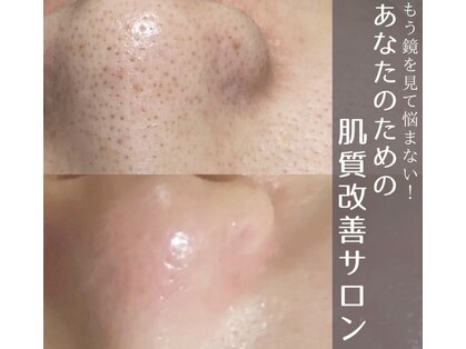 ニコラフ(Nico laugh)の写真