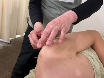 よしなが整骨院 鍼灸院の写真/二十余年、常に研鑽に努め多くのお客様に向き合ってきた鍼灸師の極上の施術！是非ご体感ください。