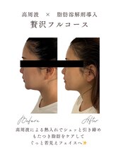 エフリア 大垣(F.lia)/もたつき脂肪を撃退！