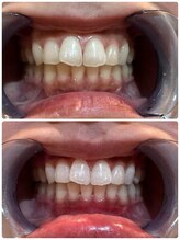 【医療提携】ホワイトニング専門店～Cinderella～/