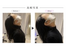 リラボ整体院 赤坂店(RE+LAB=◯整体院)/ビフォーアフター頚部