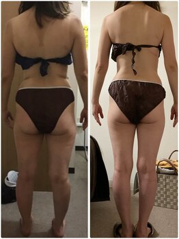 ビューティーワークスシャンティ 柏店(Beauty Works Shanti)/マイナス8キロ☆