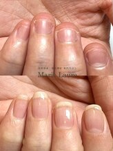 マリーロール 梅田店(Marie Laure)/自爪育成/深爪矯正/ネイルケア