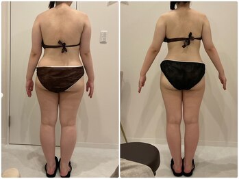 ビビ センター北店(Bibi)/ビフォーアフター