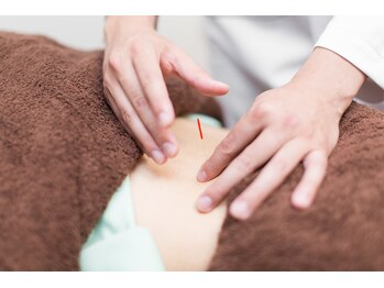 羅針堂鍼灸整体院 横浜鶴見店/鍼の施術風景【鍼灸】/横浜鶴見