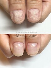 マリーロール 淀屋橋本店(Marie Laure)/自爪育成/深爪矯正/ネイルケア