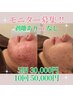 【モニター募集】剥離ありorなし選べるハーブピーリング10回50,000円
