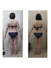 らたす(Ra+)/痩身全身コース1年後