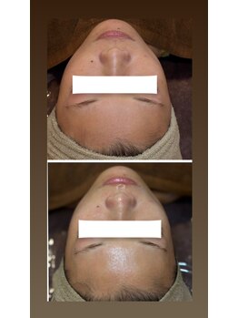 ヨロ(YOLO)/潤い鎮静トリートメント