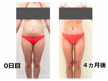 ロータスサリ/ただ痩せるだけでなく、、、