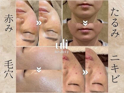 ウリ(uli beauty)の写真