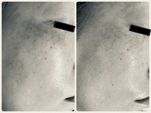 エフェクト 塚口店(effect)/Before After