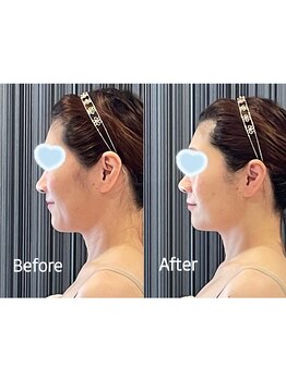 エクセレントビューティーサロン 艶(EN)/ダーマフェイシャル&アクア