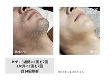 ディーエムピーコネクト(dmp connect)