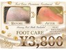 【驚きのビフォーアフター】頑固な角質ごっそり除去＋極上保湿