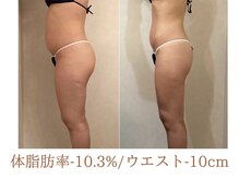 美ジン なかもず(美JIN)/セルゼロ全身18回
