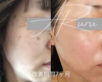 アルルプラス 南草津(ARuru+)