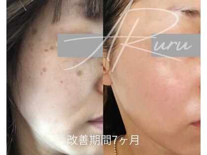 アルルプラス 南草津(ARuru+)の写真