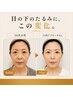 目の下クマ・たるみ改善【疲れて見える目元に】小顔矯正60分