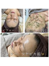 ヴィオナス(Veonus)/最高のツヤ肌