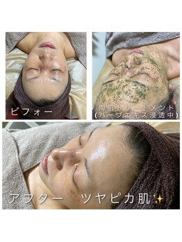 ヴィオナス(Veonus)/最高のツヤ肌