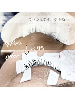 シリーラッシュ 自由が丘南口/ラッシュアディクトの効果