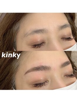 キンキー 広島(kinky)/