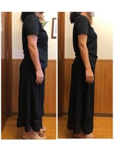 リンドール(RinDoll)/50代女性ダイエット/耳ツボ/痩身