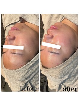 ディオーネ 春日井勝川店(Dione)/マーメイドセルトリートメント