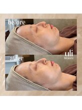 ウリ(uli beauty)/比較写真