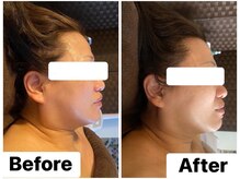 イオム ビューティワーク(IOM BEAUTY WORK)/