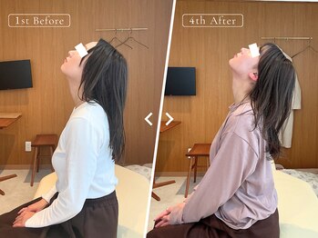 リリーフポート フェミナ鍼灸整体院 大濠公園店/お悩み：産後の身体の不調