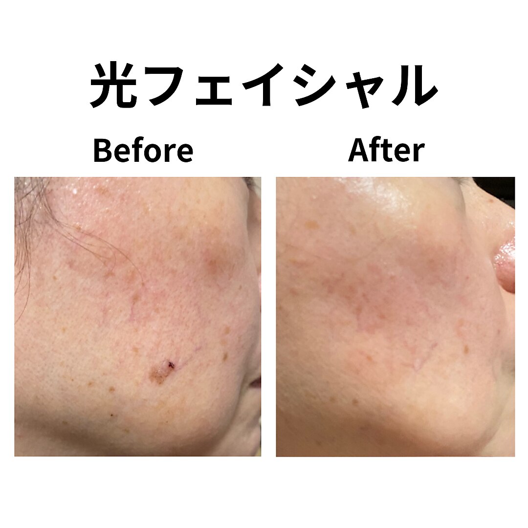 ラヴィアンローズ｜ホットペッパービューティー