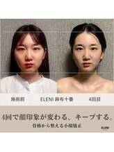 エレーニ 麻布十番(ELENI)/顔印象が変わる、キープする。