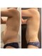 心斎橋 ルヴィ(REVI)の写真/【男性のお客様大歓迎!】モテBODYへ!そのぽっこりお腹を本気で変える◎結果重視★ハイパーナイフEX