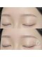 モンド 恵比寿店(Mond)の写真/【眉毛サロン】顔脱毛も人気♪眉毛のみならずお得に顔脱毛も可能！毛穴汚れ産毛や角質、皮脂を取り透明感UP