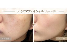 ラディアンスの雰囲気（丁寧なカウンセリング/前橋/渋川/吉岡/中之条/艶玉肌/シミケア）