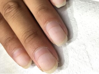 メテ(mete)/《オフ》