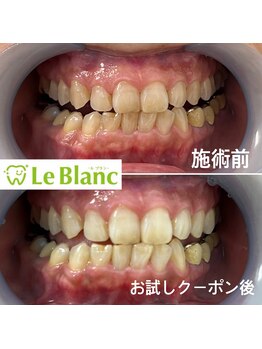 ルブラン 奈良店(Le Blanc)/15分1回1660円!