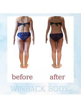 ミュー(professional beauty salon MYU)/ウィンバックボディ