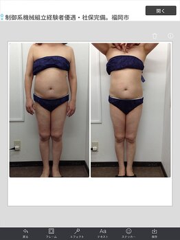 健康痩身研究所 蟹江店/ビフォーアフター