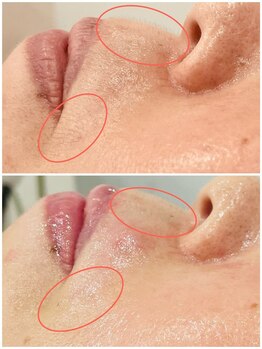 プチ プロムナード(Petit Promenade)/美肌フェイスワックス