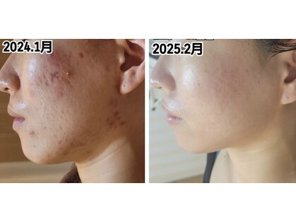 エステティック レイビス 銀座店(RAYVIS)の写真