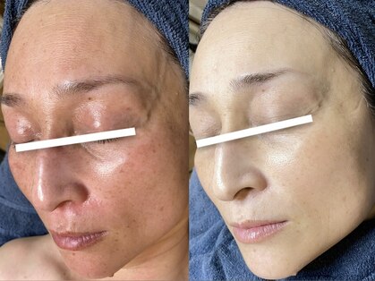 ソリッジ肌管理室の写真