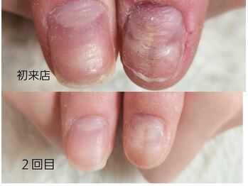 グラシナ 鳥丸店/矯正しながらアートもできます