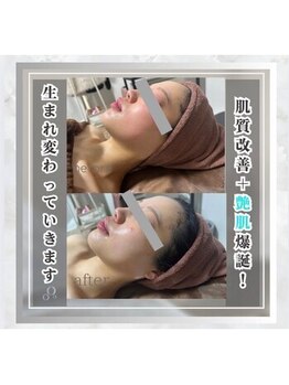 エッセンシャル 南海難波店(ESSENTIAL)/【ツヤ肌爆誕】