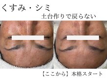 セレニア ボーテ(Selenia Beaute)/